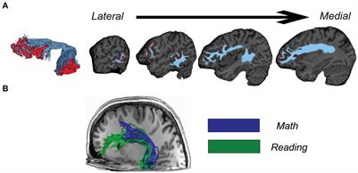 A practical guide for combining functional regions of interest and white matter bundles